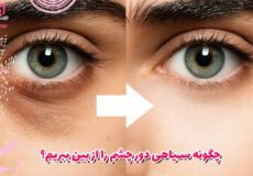 چگونه سیاهی دور چشم را از بین ببریم؟