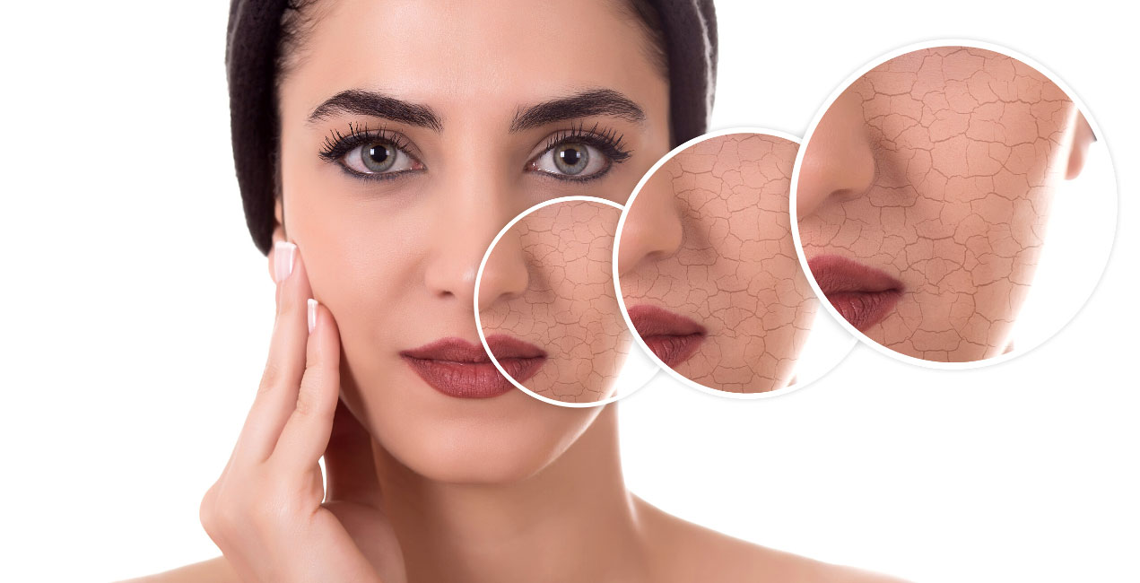 پوست خشک dry skin