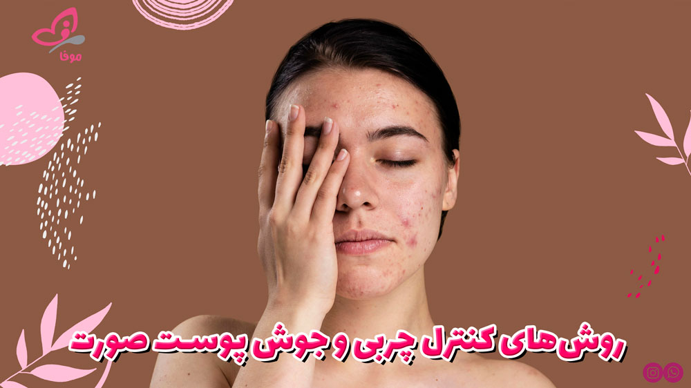 روش‌های کنترل چربی و جوش پوست صورت