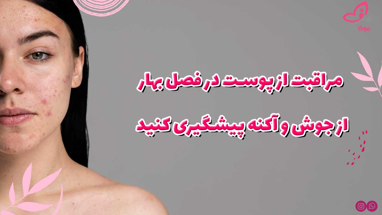 مراقبت از پوست در فصل بهار: از جوش و آکنه پیشگیری کنید