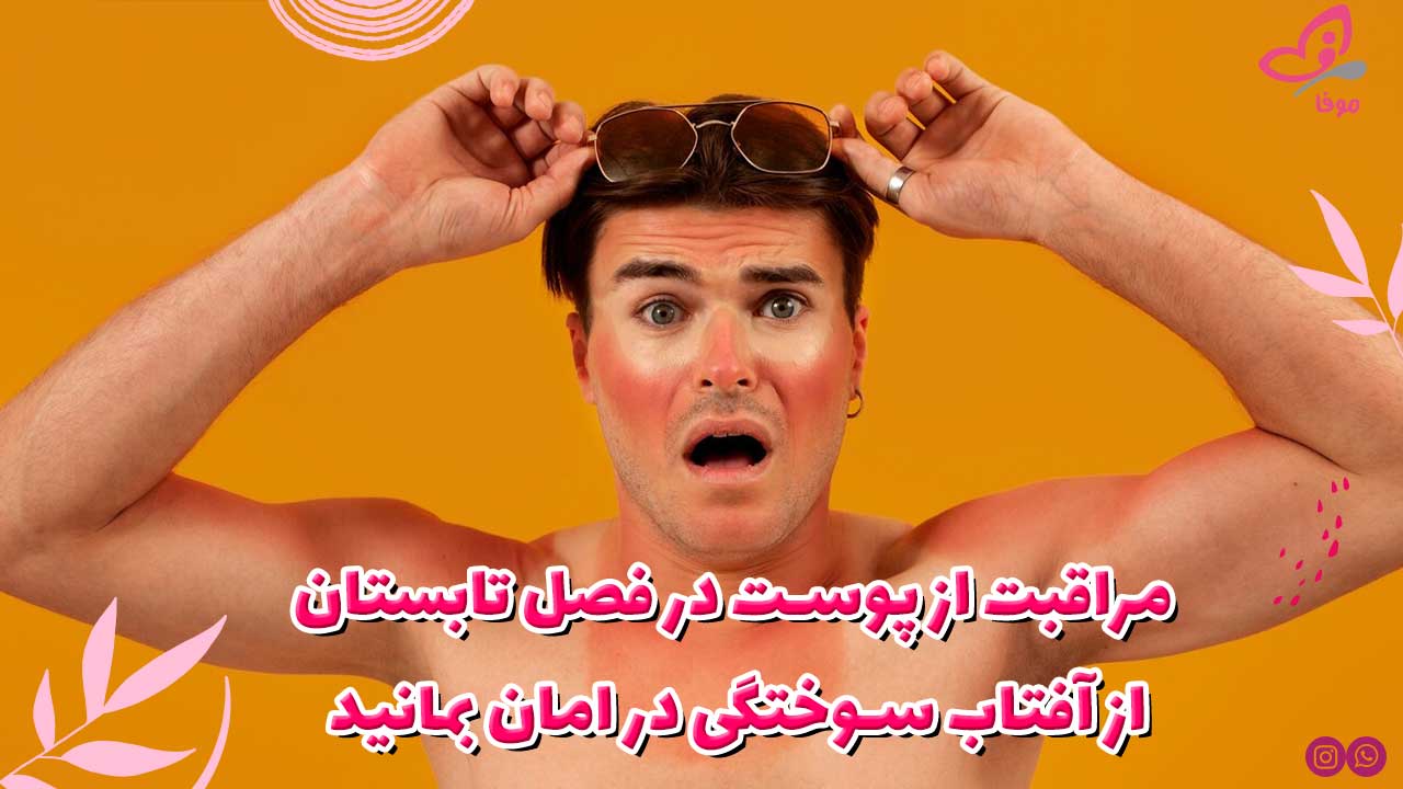 مراقبت از پوست در فصل تابستان: از آفتاب سوختگی در امان بمانید