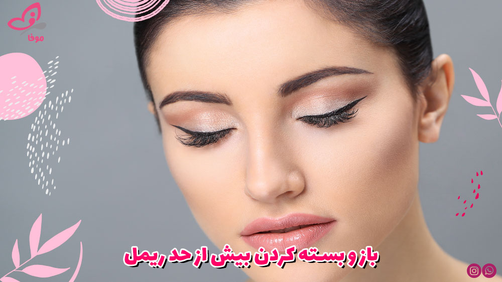 باز و بسته کردن بیش از حد ریمل