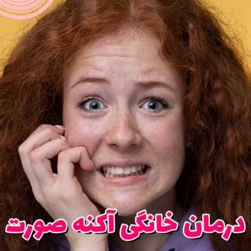 درمان خانگی آکنه صورت