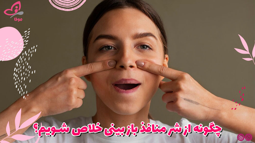 چگونه از شر منافذ باز بینی خلاص شویم؟
