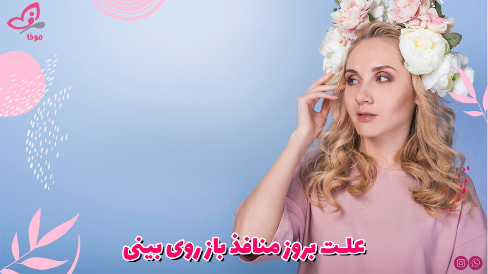 علت منافذ روی بینی چیست؟