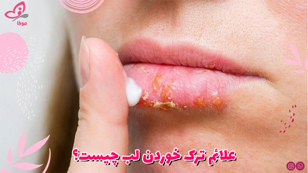 علائم ترک خوردن لب چیست؟