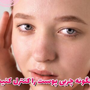 how to control oily skin