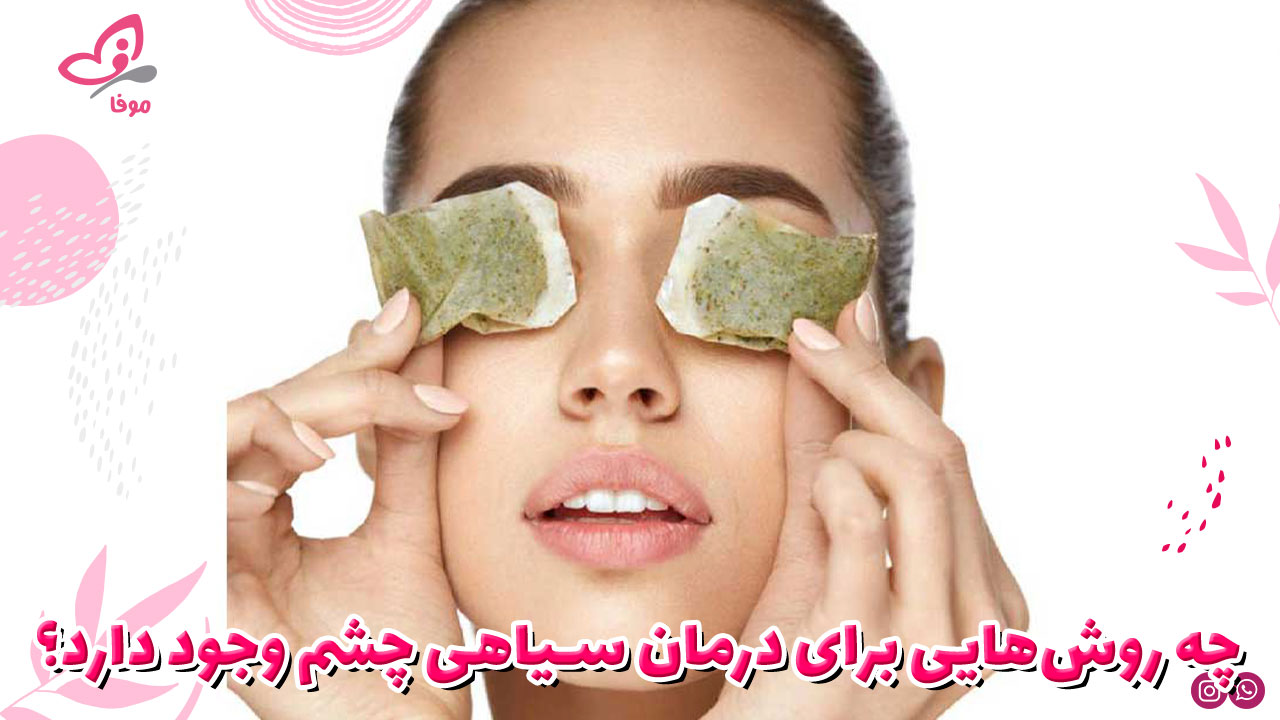 چه روشهایی برای درمان سیاهی چشم وجود دارد؟