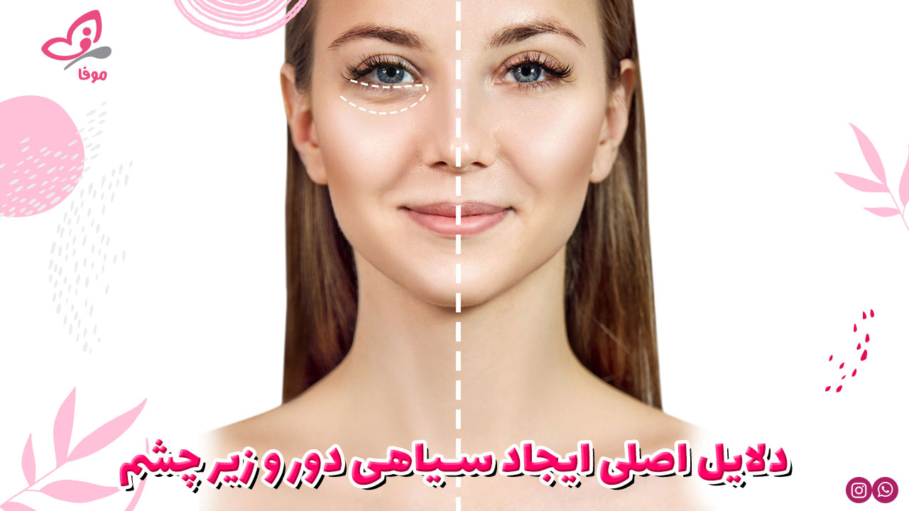 ۱۰ دلیل اصلی ایجاد سیاهی دور و زیر چشم